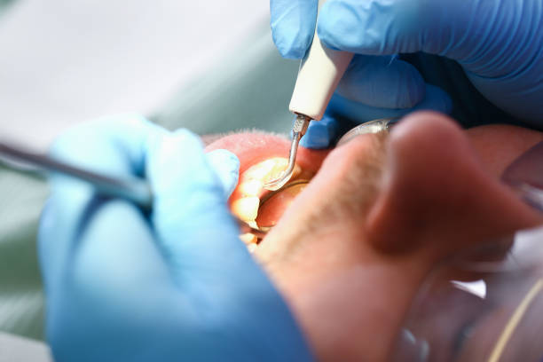 Best Emergency Treatment for Toothache in St James, NC