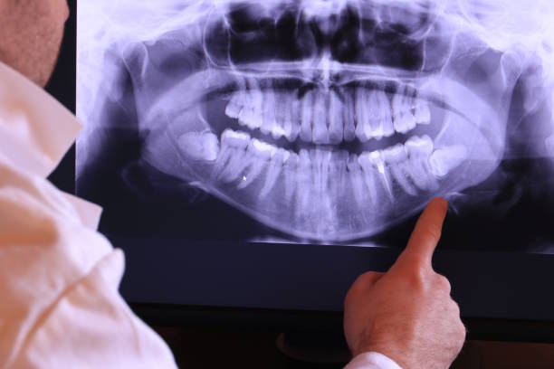 Best Emergency Tooth Extraction in St James, NC