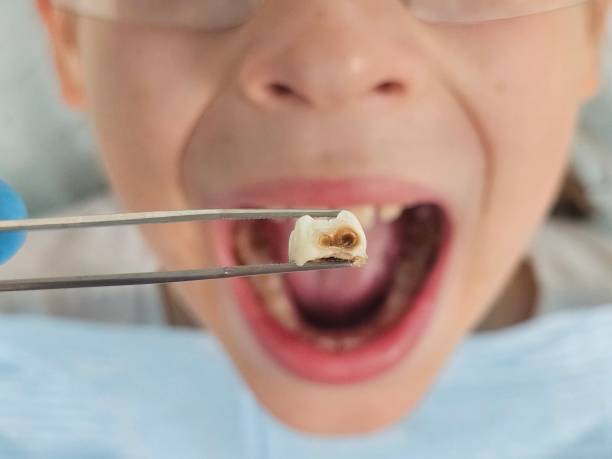 Best Walk-In Emergency Dentist in St James, NC